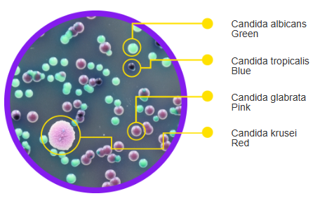 Candida Chromogenic Agar